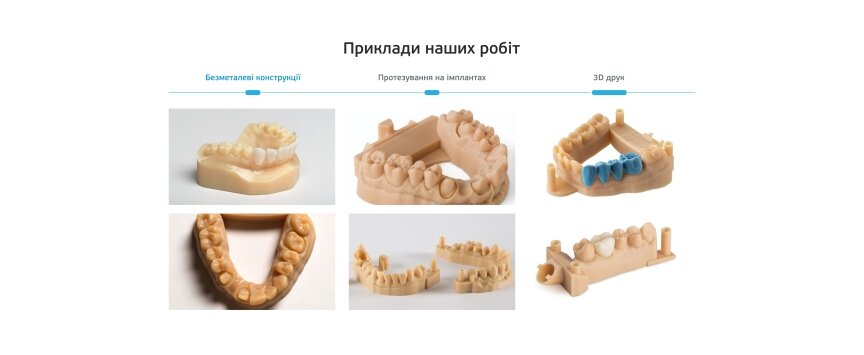 interior page design on the topic Tematyka medyczna — Jednostronicowa witryna laboratorium dentystycznego AlphaDent 2