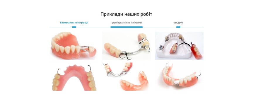 дизайн внутрішніх сторінкок на тему Медична тематика — Односторінковий сайт для зуботехнічної лабораторії АlphaDent 3